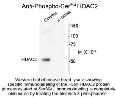 Western Blot: HDAC2 [p Ser394] Antibody [NBP2-29519] - Western blot of mouse heart lysate showing specific immunolabeling of the ~55k HDAC2 protein phosphorylated at Ser394 (control). Phosphospecificity is shown in the second lane. The blot is identical to the control except that the lysate was incubated in lambda-Ptase (800 units/1mg protein for 30 min). The immunolabeling is completely eliminated by treatment with lambda-Ptase.